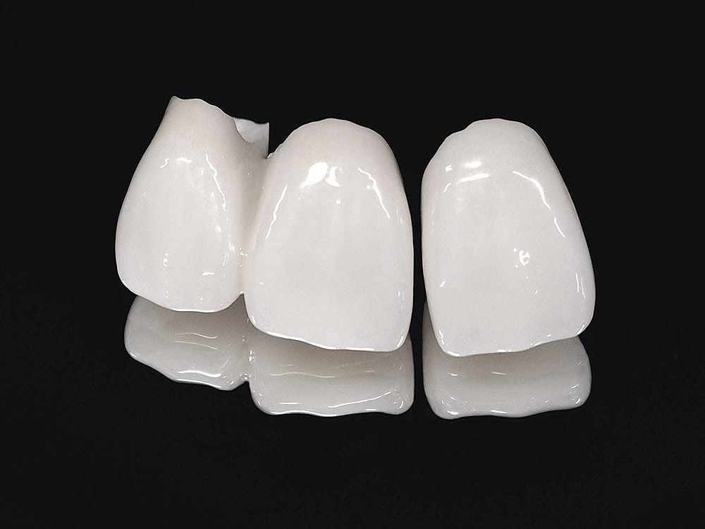 オールセラミック