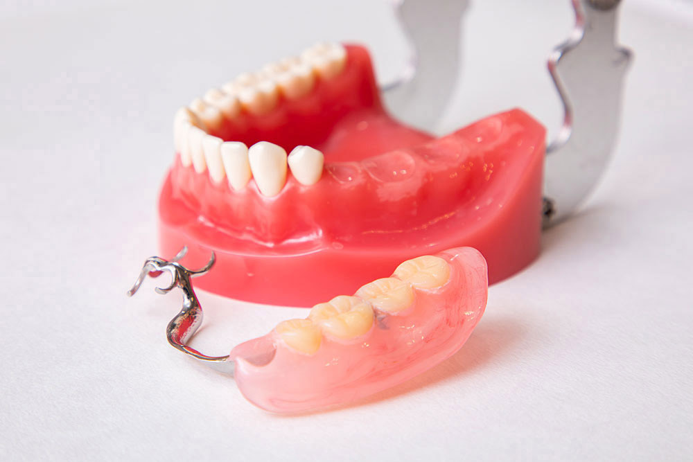 保険診療の入れ歯