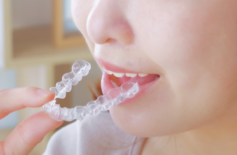 目立ちにくいマウスピース矯正